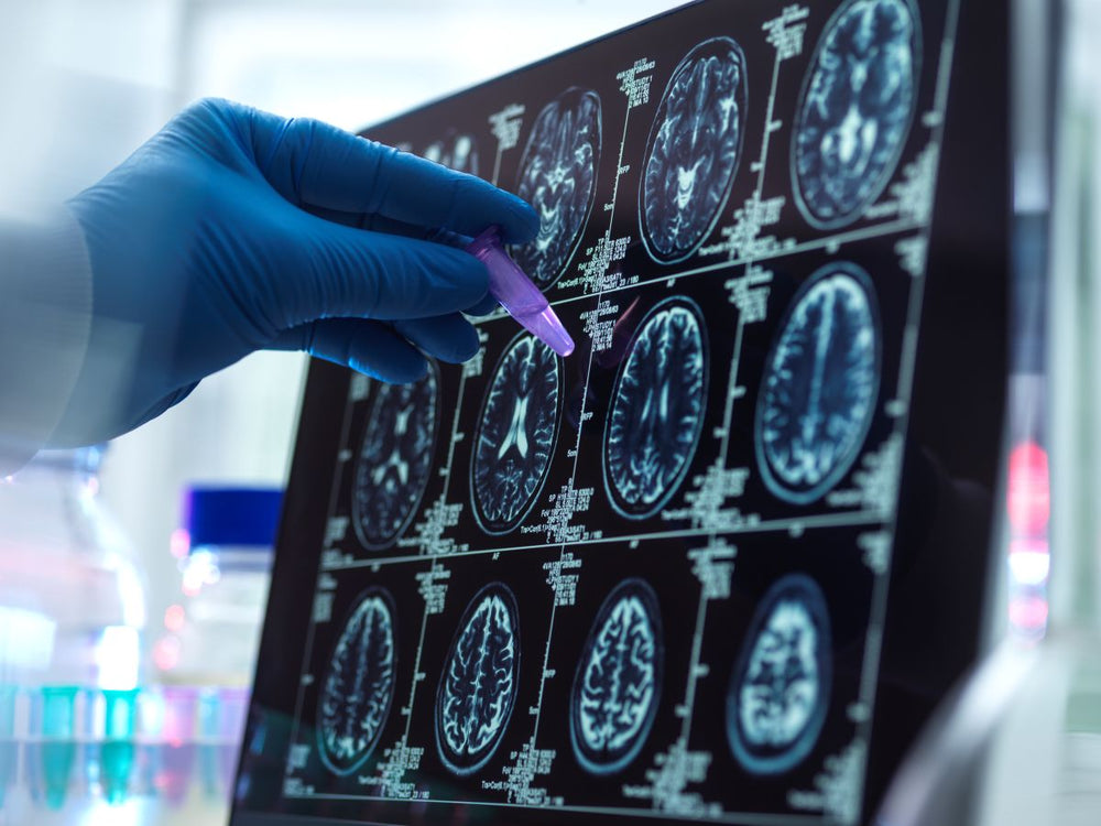 Methylene Blue for Dementia & Alzheimer’s