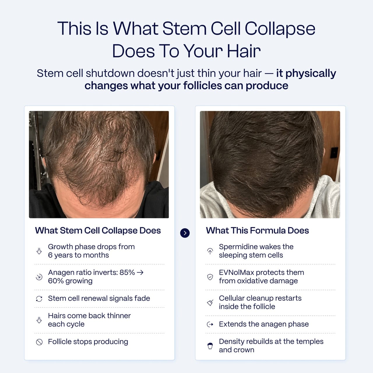 Hairmidine | Multi-Pathway Hair Growth Support Formula
