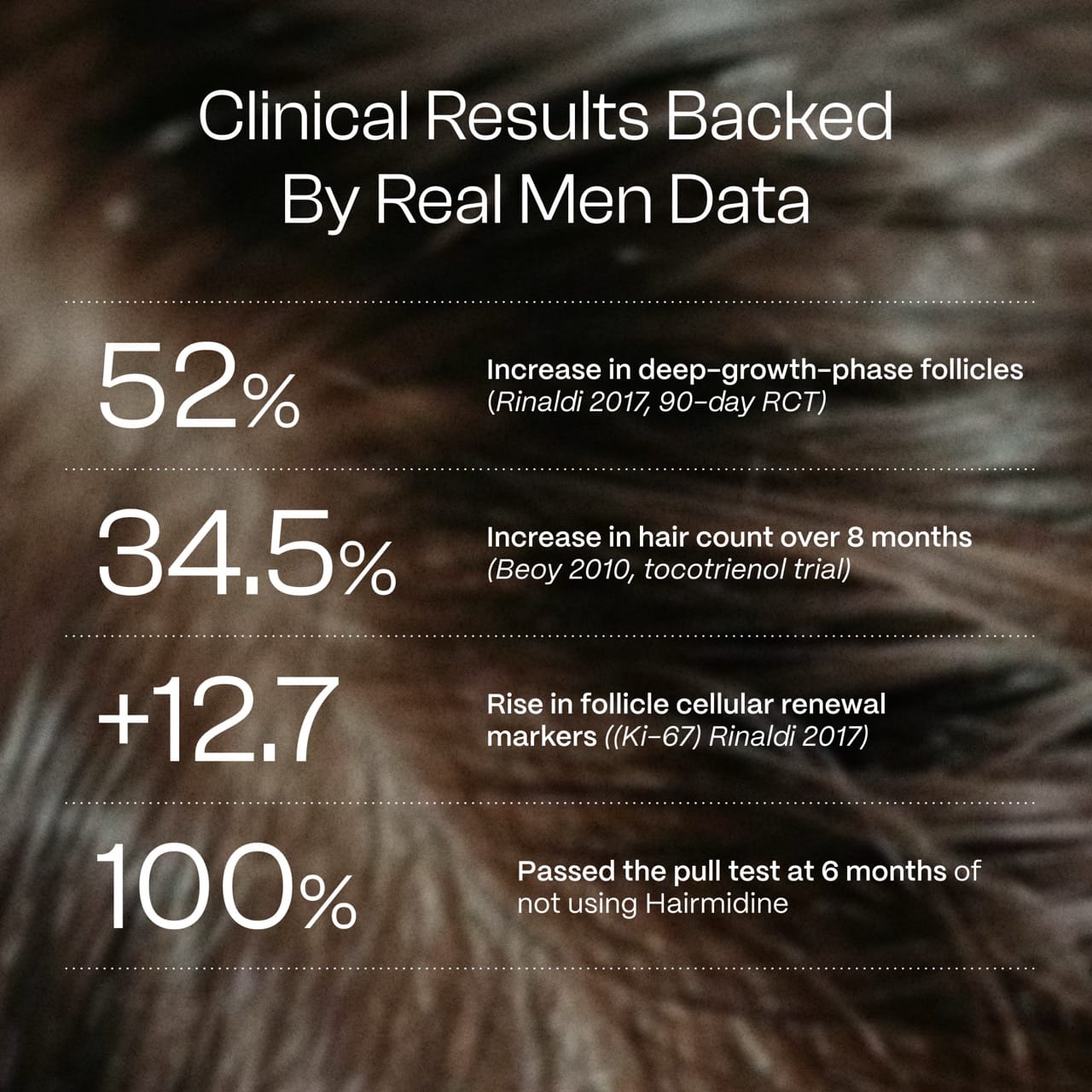 Hairmidine | Multi-Pathway Hair Growth Support Formula